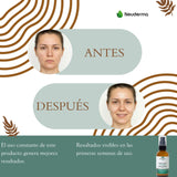 Suero Facial con Niacinamida + Ácido Hialurónico + Hamamelis + Aloe Vera 60ml